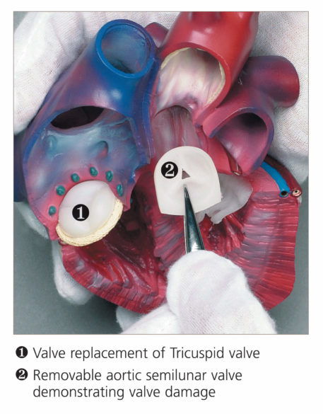 Life Size Diseased Heart Model - Image 3