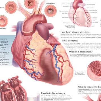 Cardiovascular