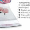 Life Size Healthy Heart Model - Image 2