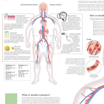 Metabolic Syndrome