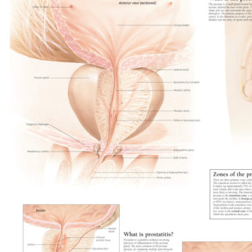 Prostate