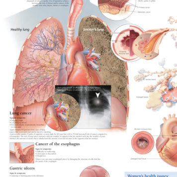 Effects of Smoking