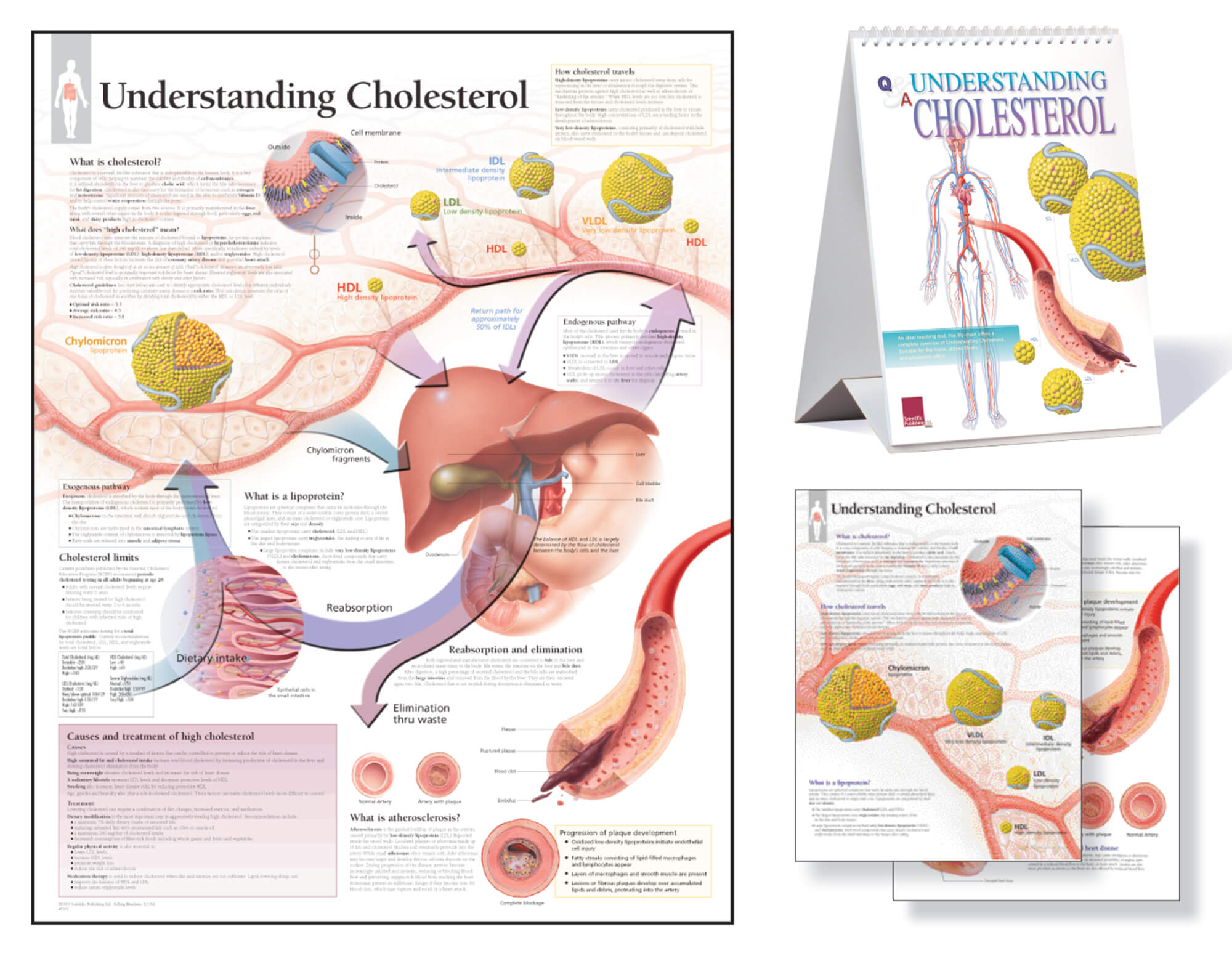 cholesterol patient education