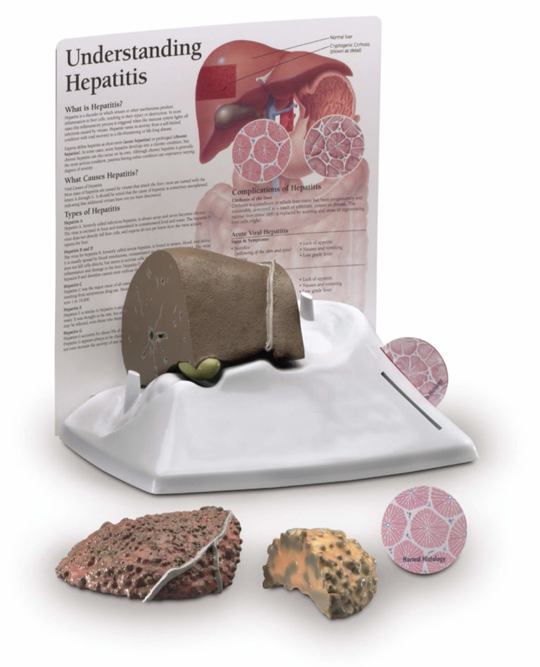 Understanding Hepatitis Model - Scientific Publishing