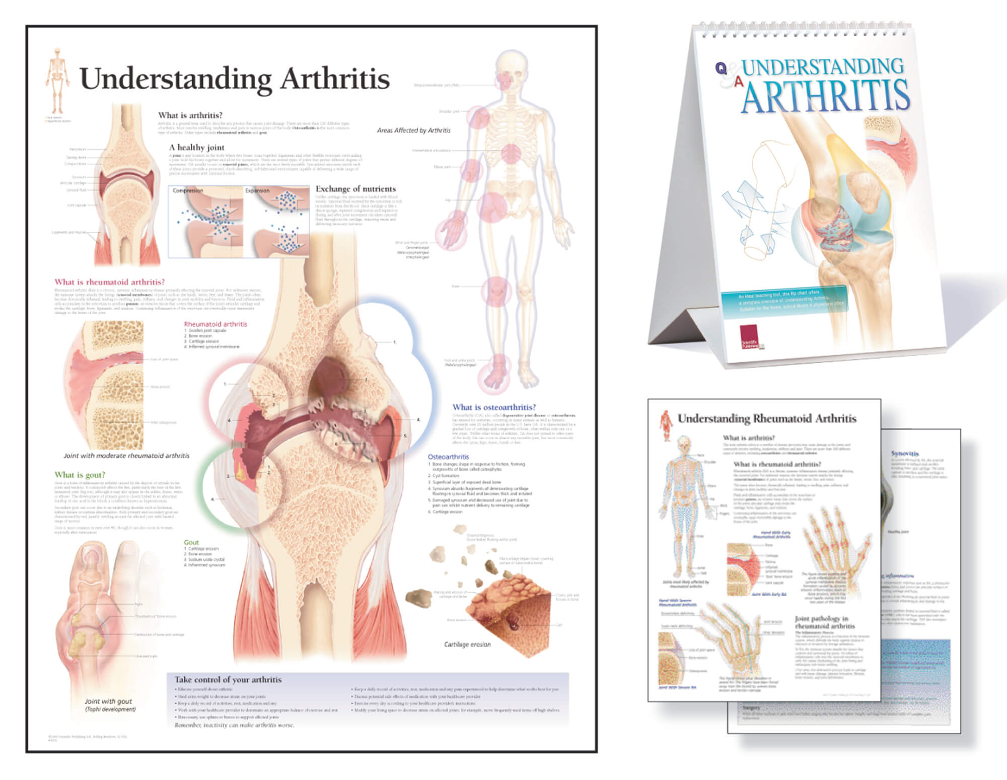 Understanding Arthritis Study Set | Scientific Publishing