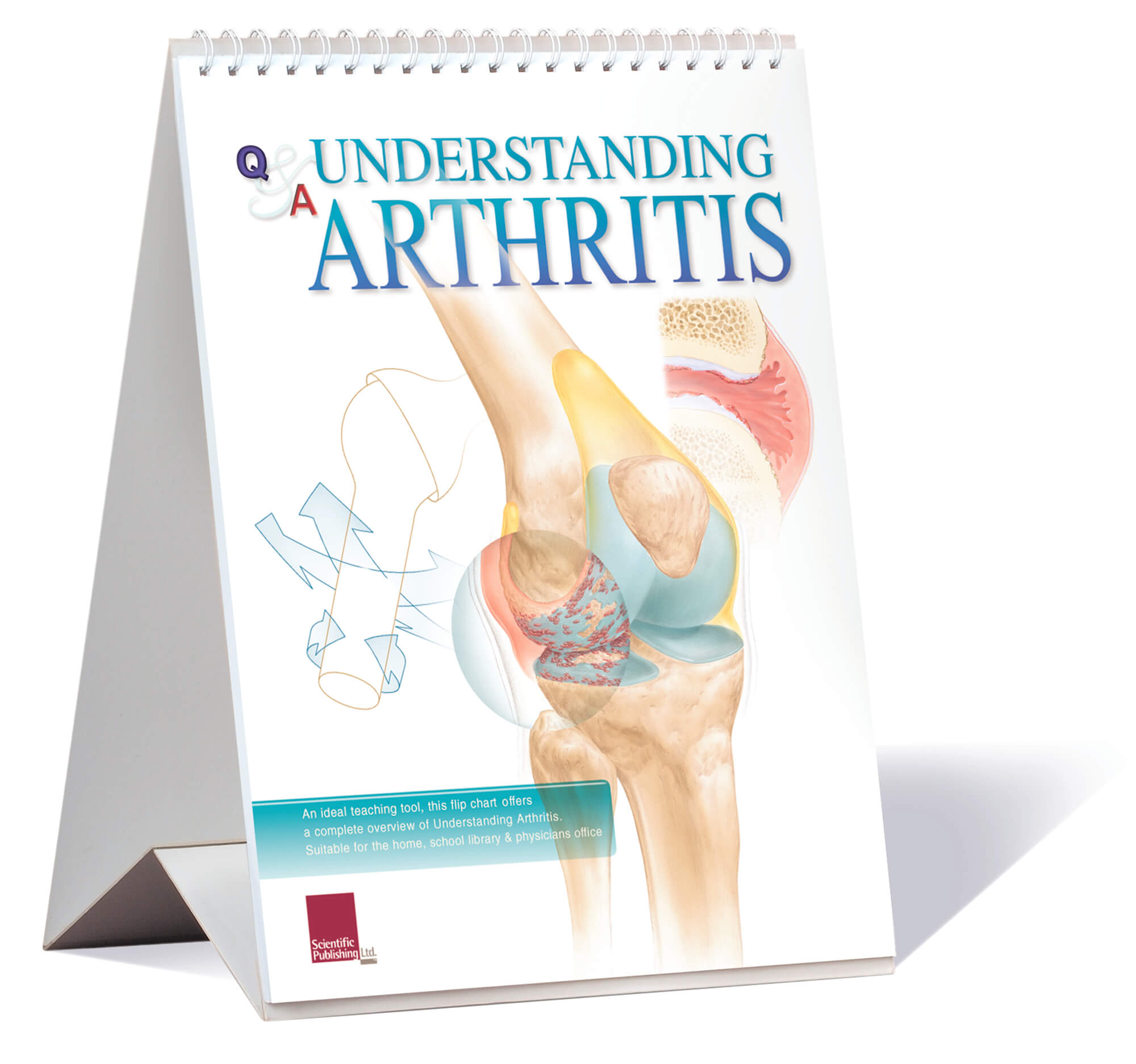 arthritis flip chart