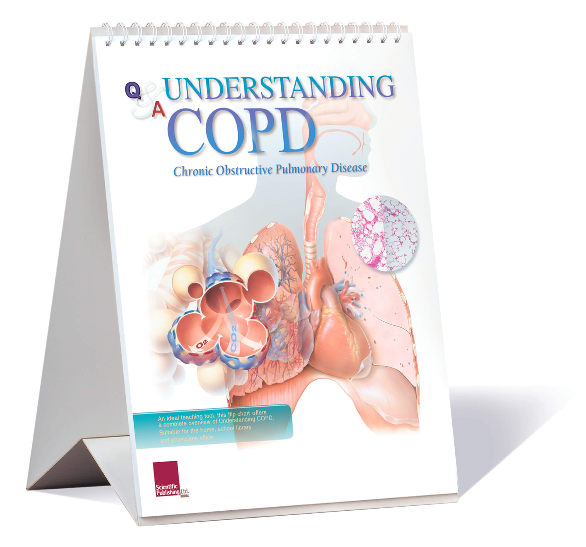 Understanding COPD Flip Chart