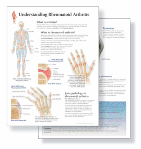 Understanding Arthritis Study Set (Replacement pads)