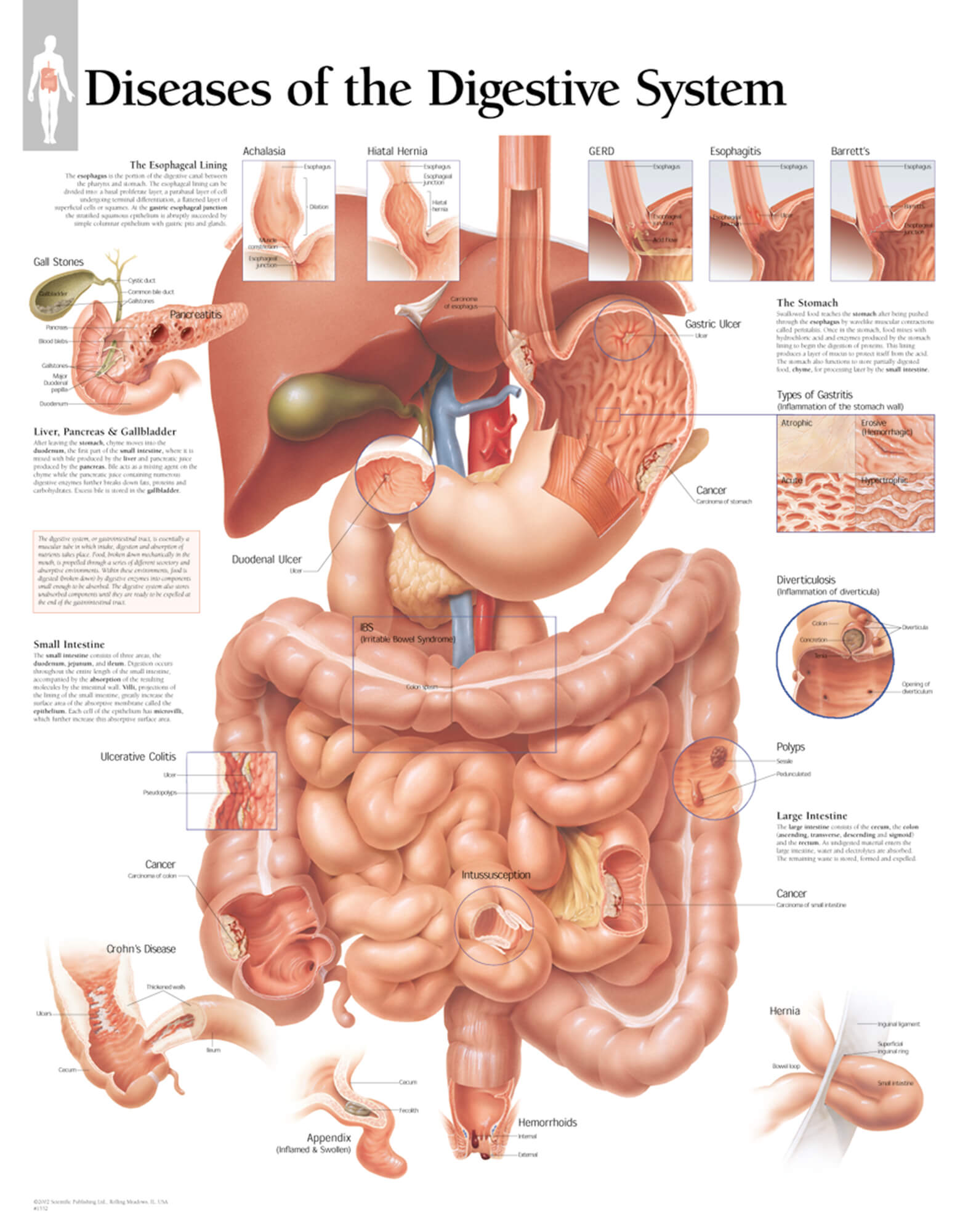 Diseases Of The Digestive System Anatomical Chart