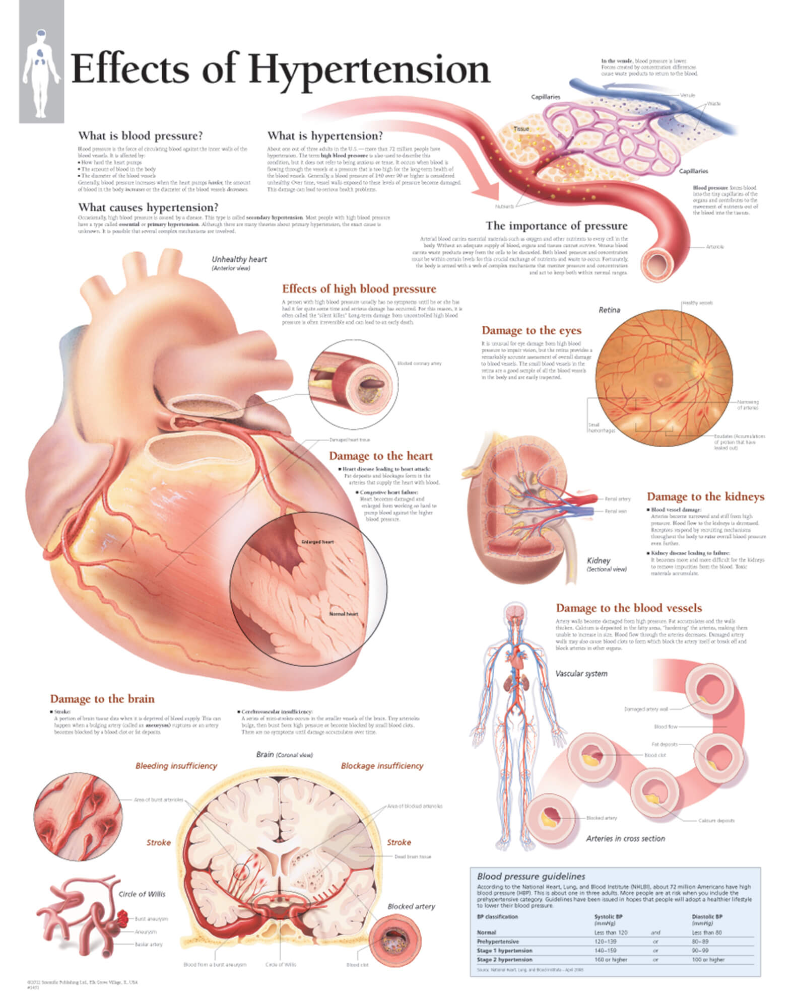 high blood pressure effects