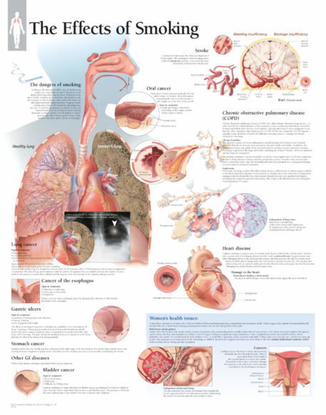 effects of smoking lung cancer