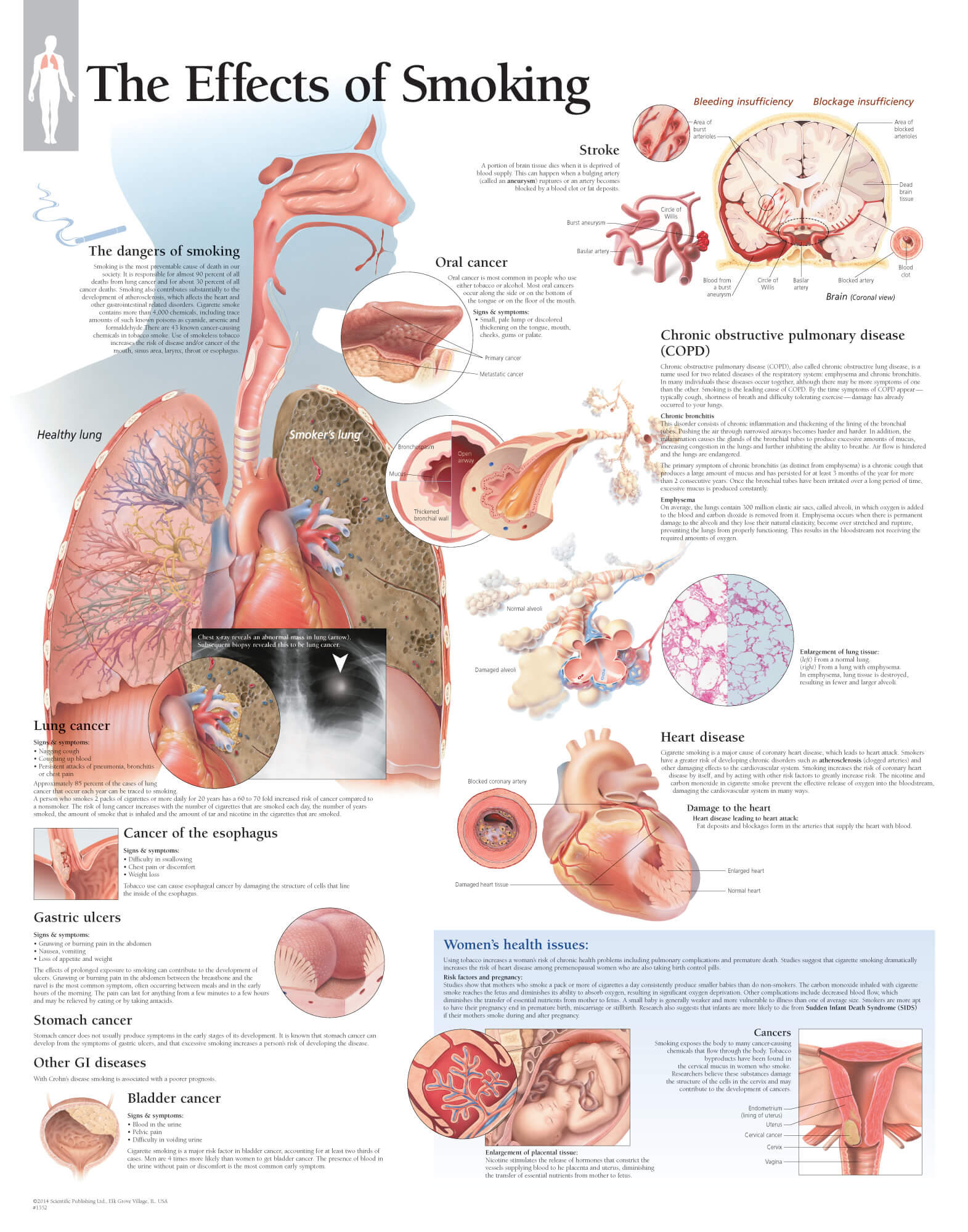 effects of smoking on the lungs