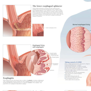 Disorders & Conditions