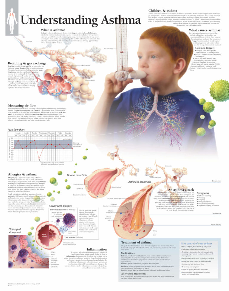 Understanding Asthma | Scientific Publishing