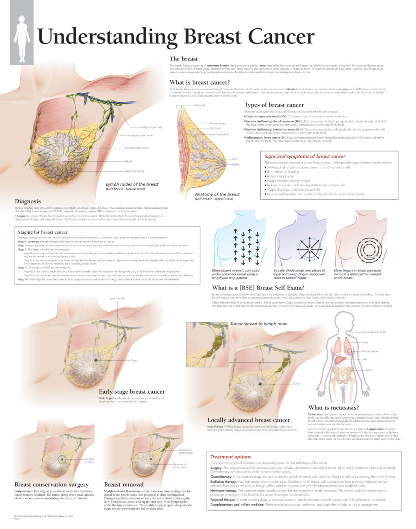 Breast Types Chart