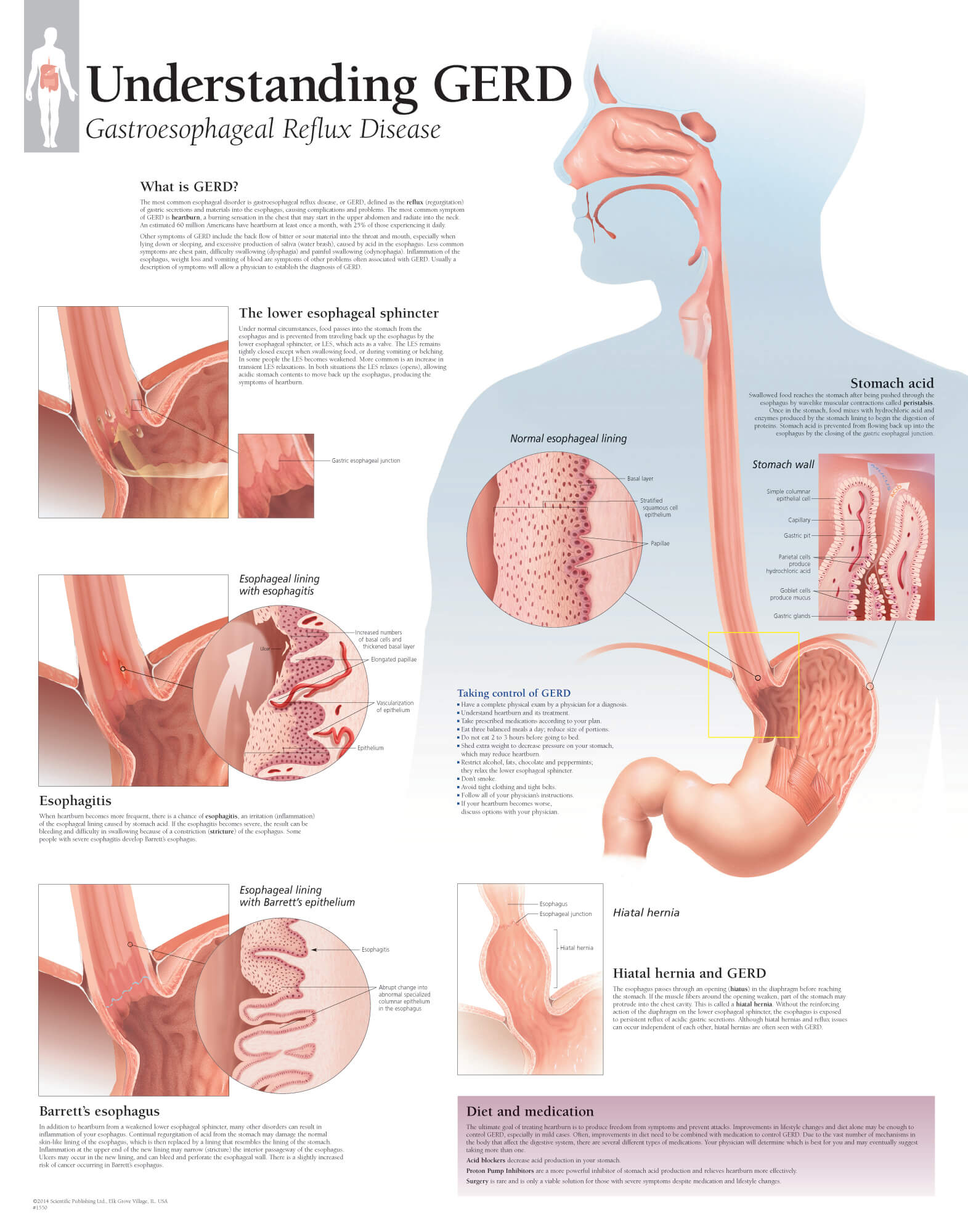 Gastroesophageal Disorders Anatomical Chart