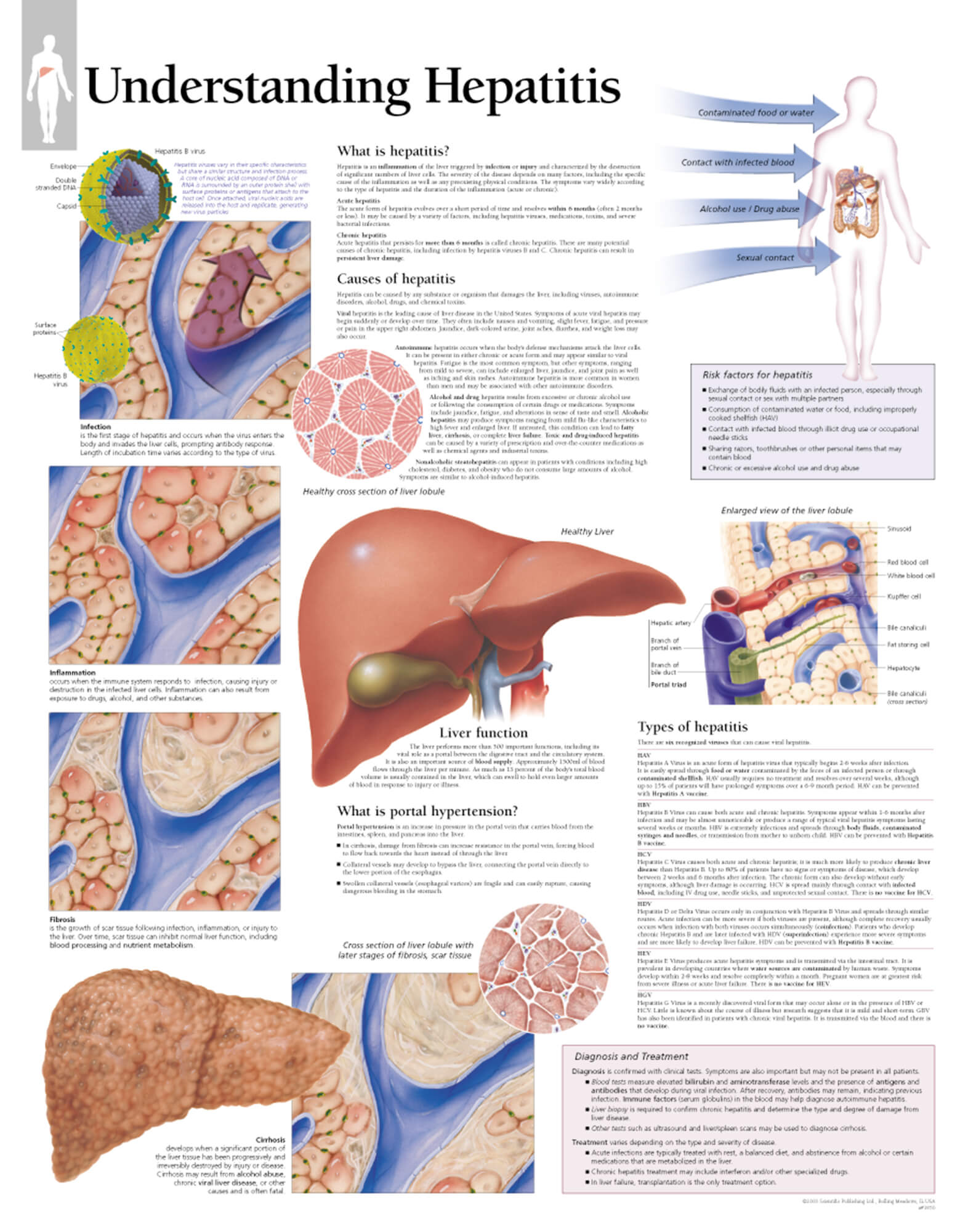 hepatitis