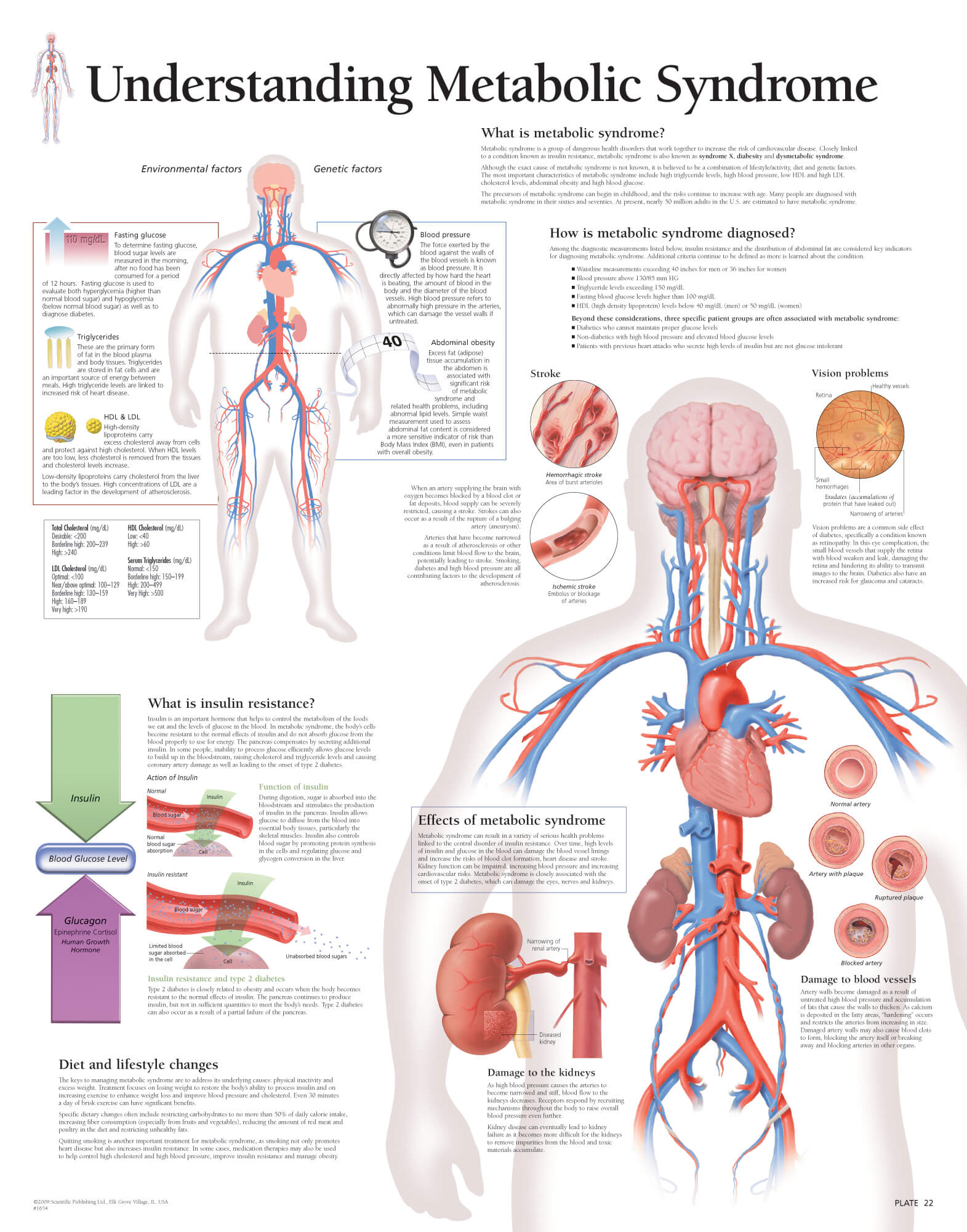 metabolic syndrome