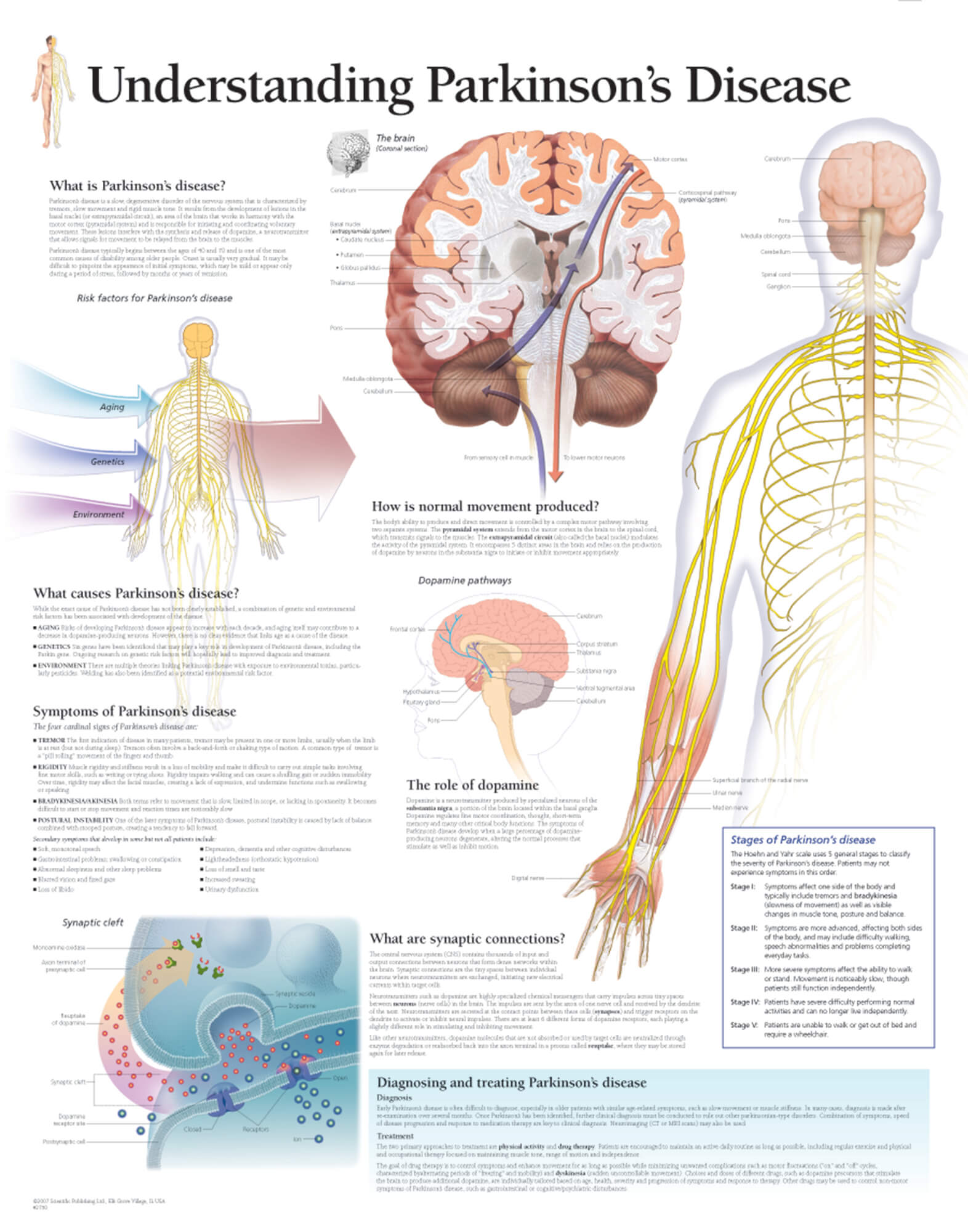 parkinsons disease