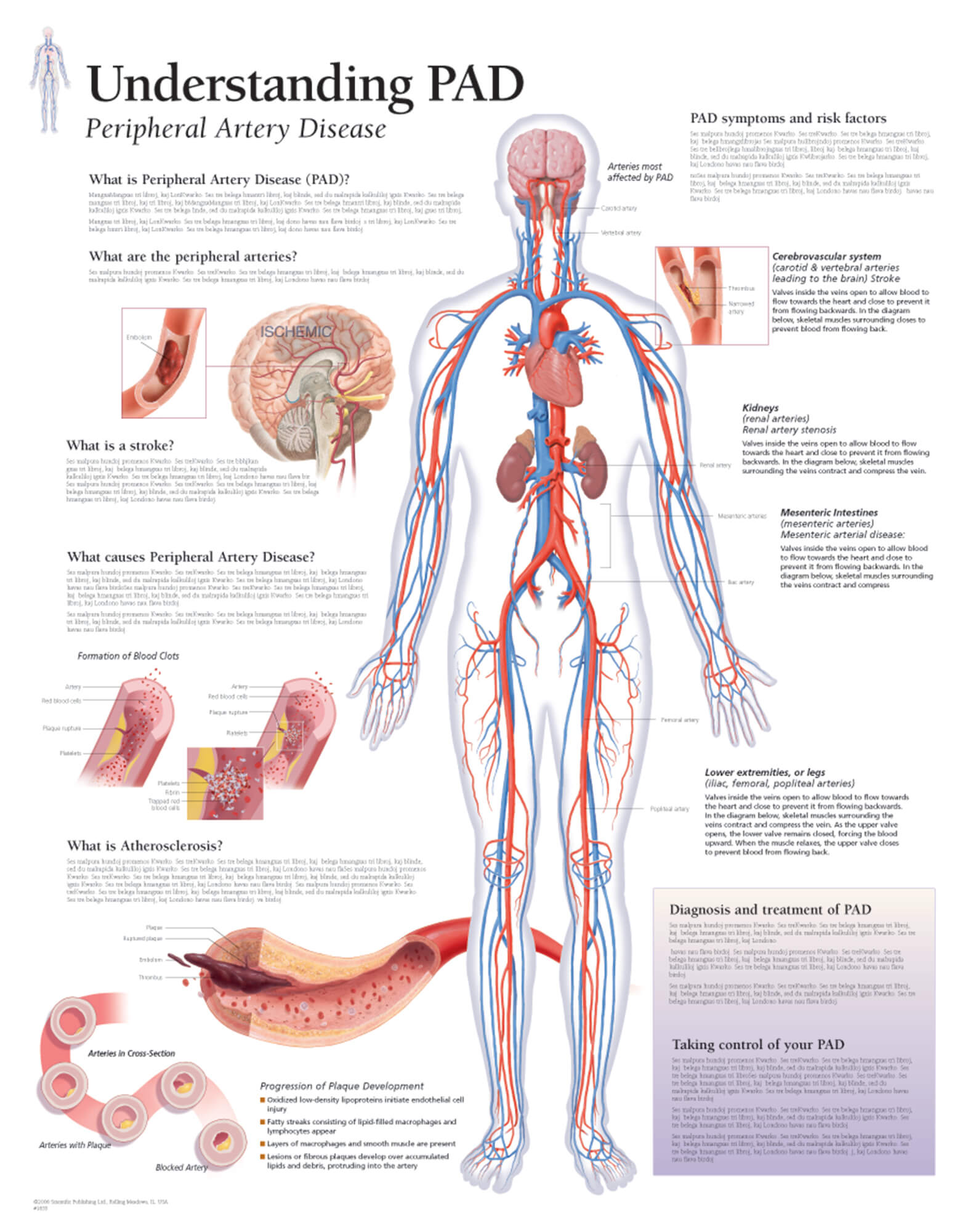 Understanding PAD | Scientific Publishing