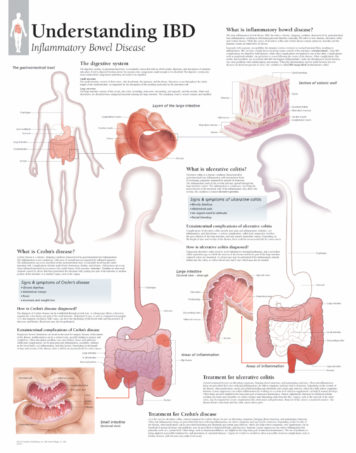 Scientific Publishing 1450F Understanding Hypertension Flip Chart